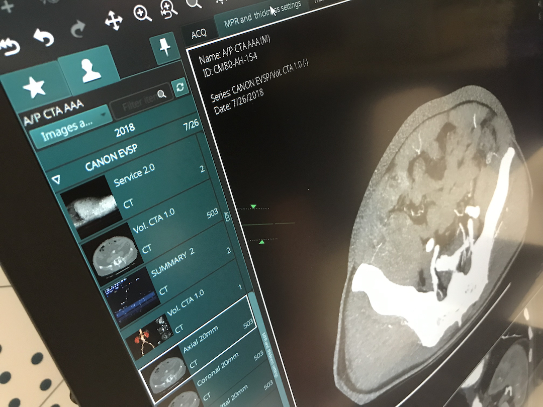 Canon's Vitrea PACS enterprise imaging system was one of several systems demonstrated at HIMSS 2021 that had easily modified hanging protocols. This included ease of use to customize what each radiologists prefers, including slice thickness. #HIMSS #HIMSS21