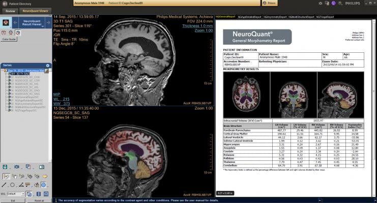 Delaware Imaging Network Now Offers NeuroQuant Brain Imaging MRI Software