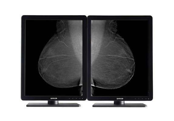 Barco, Nio 5MP LED, flat panel displays, mammography