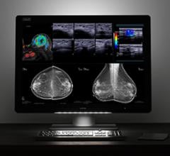 Barco Shares Latest Advances in Multimodality Diagnostic Imaging at RSNA 2017