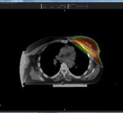 University of Arizona to Develop New CT-Based Breast Cancer Diagnostic Imaging Method