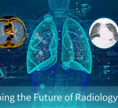 The future of radiology IT is with artificial intelligence (AI).