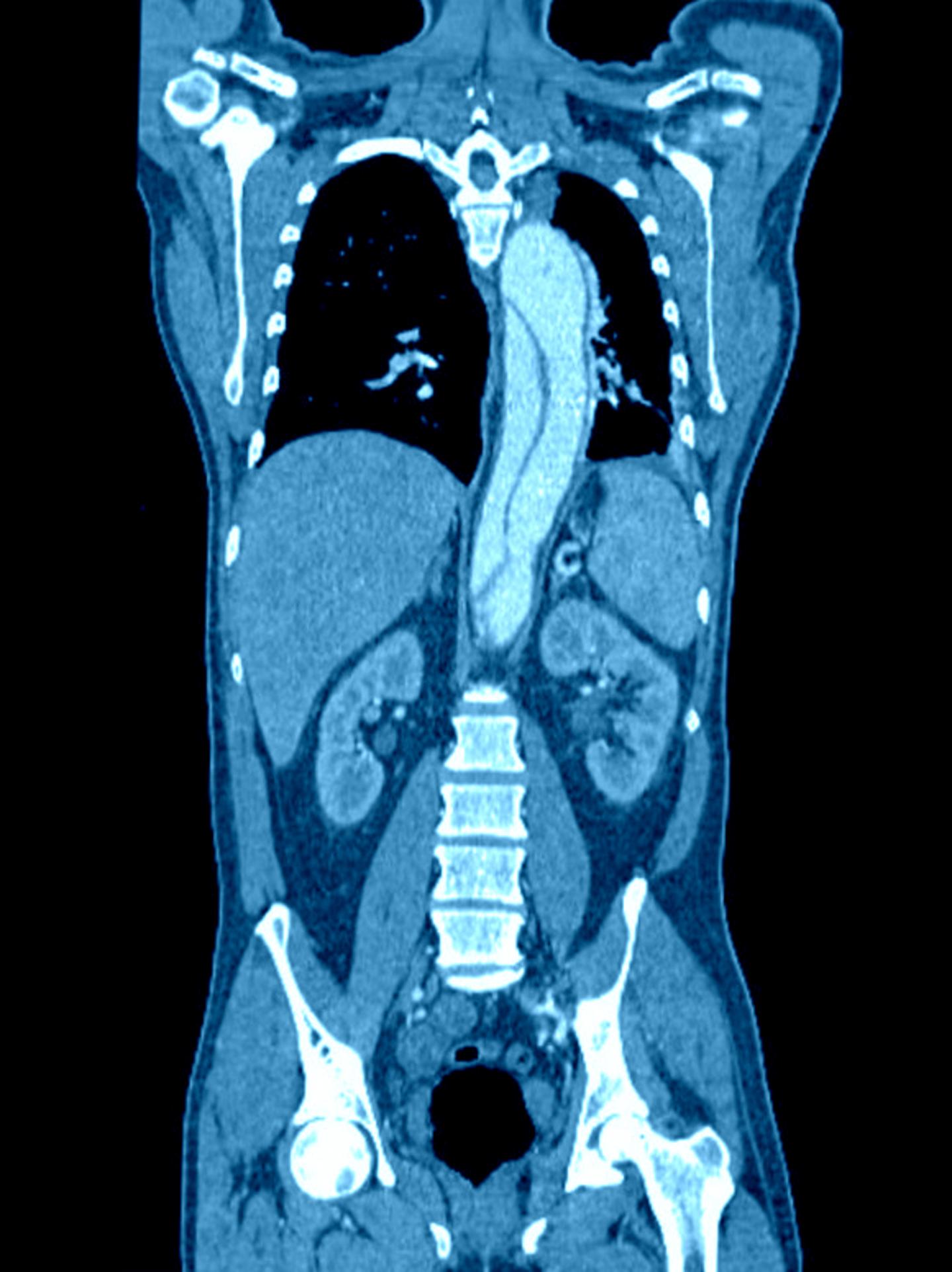Intravascular Contrast Media for Radiography, CT, MRI and
