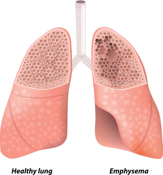 number of identified compounds in cigarette smoke Cigarette smoke is a mixture of thousands of chemicals generated from