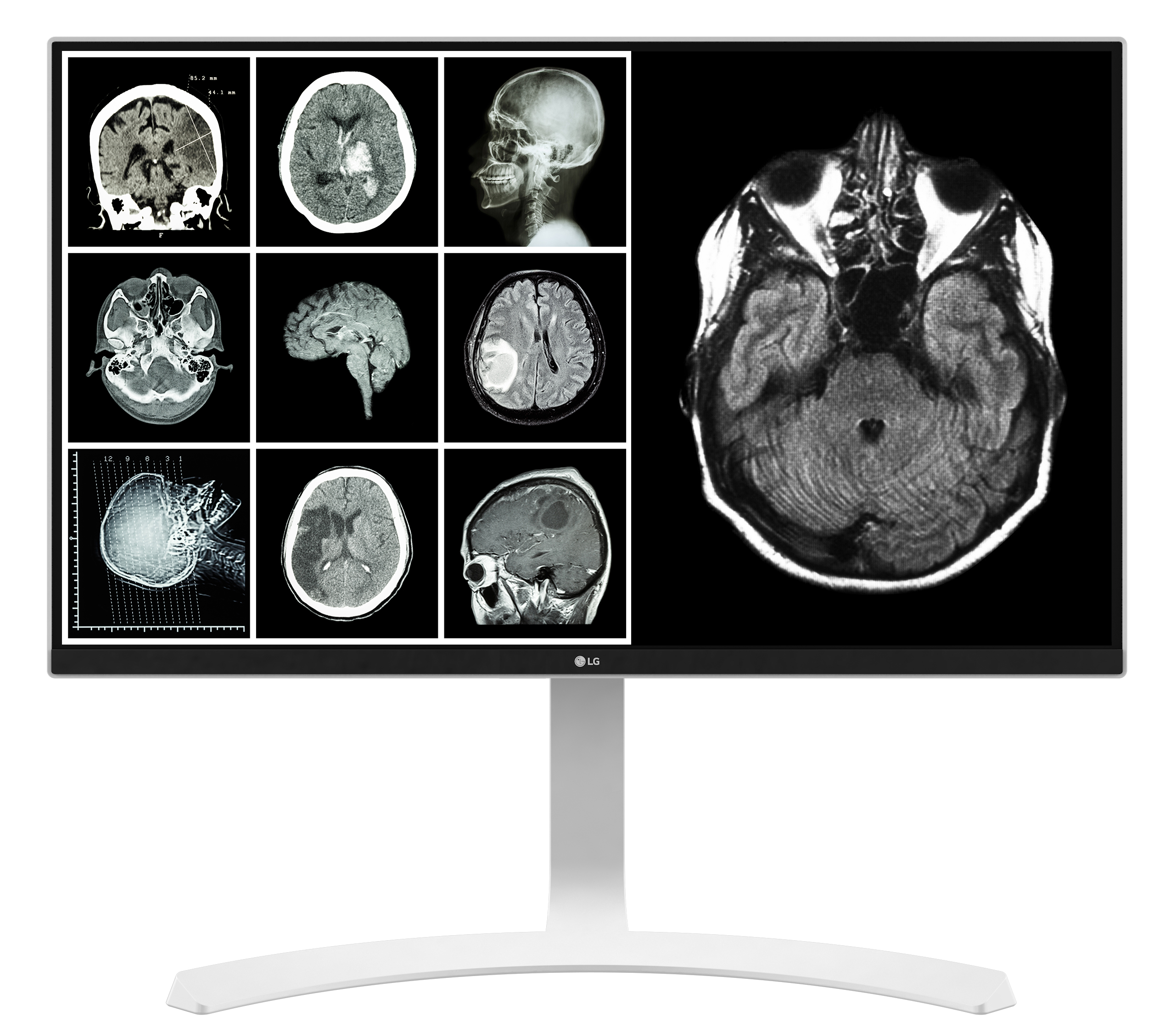 LG Unveils New Diagnostic Monitor, Digital X-ray Detectors at RSNA