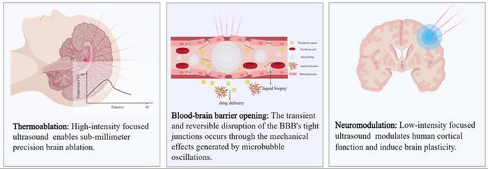 Magnetic Resonance-guided Focused Ultrasound in Intracranial
