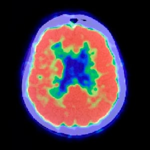 http://www.itnonline.com/sites/default/files/PET%20Scan%20brain%20GettyImages-157435280.jpg