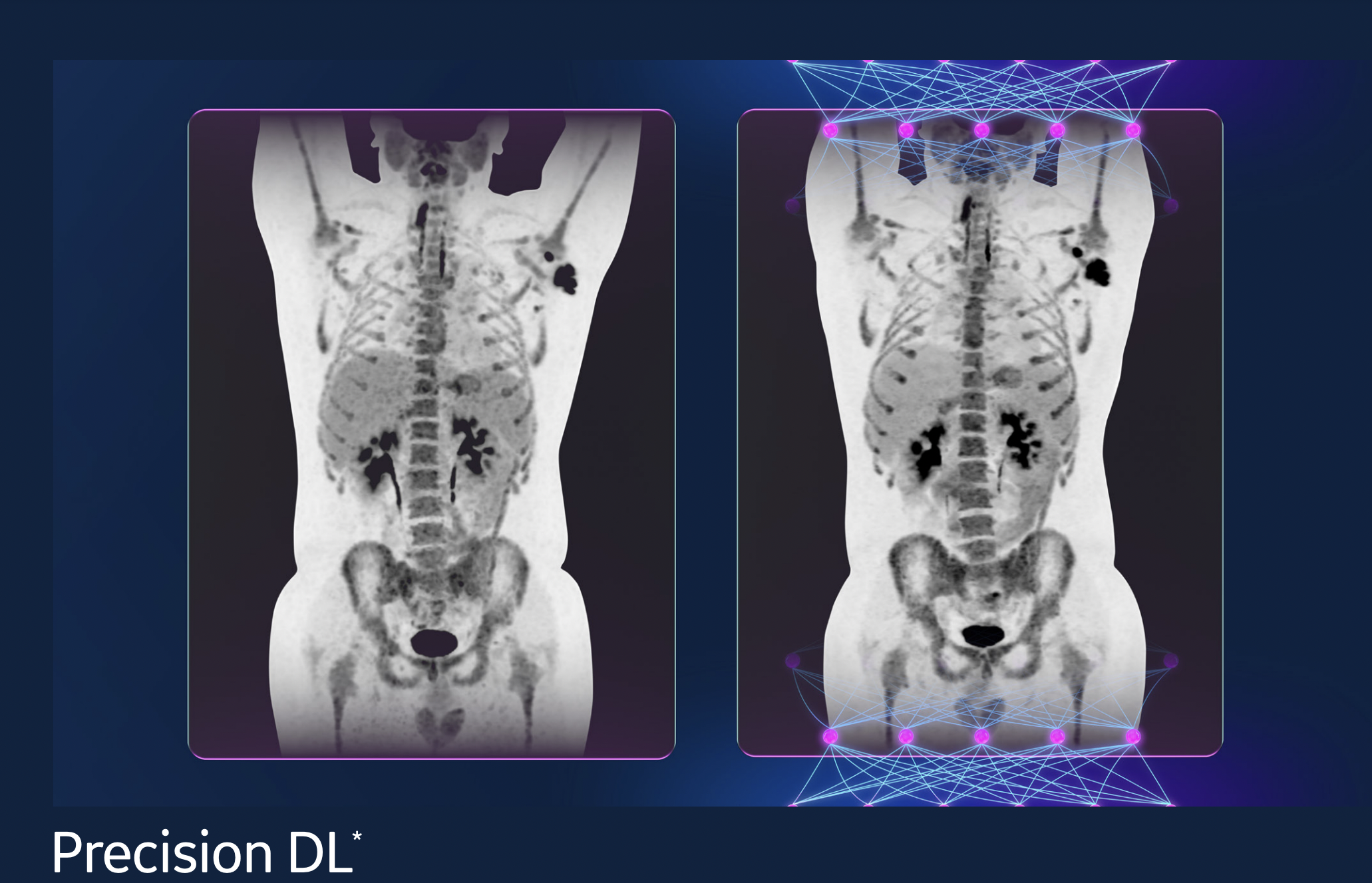 GE HealthCare Receives FDA Clearance of a New Deep Learning Solution for  Enhanced Image Quality in PET/CT, Advancing its Leadership Position in AI |  Imaging Technology News