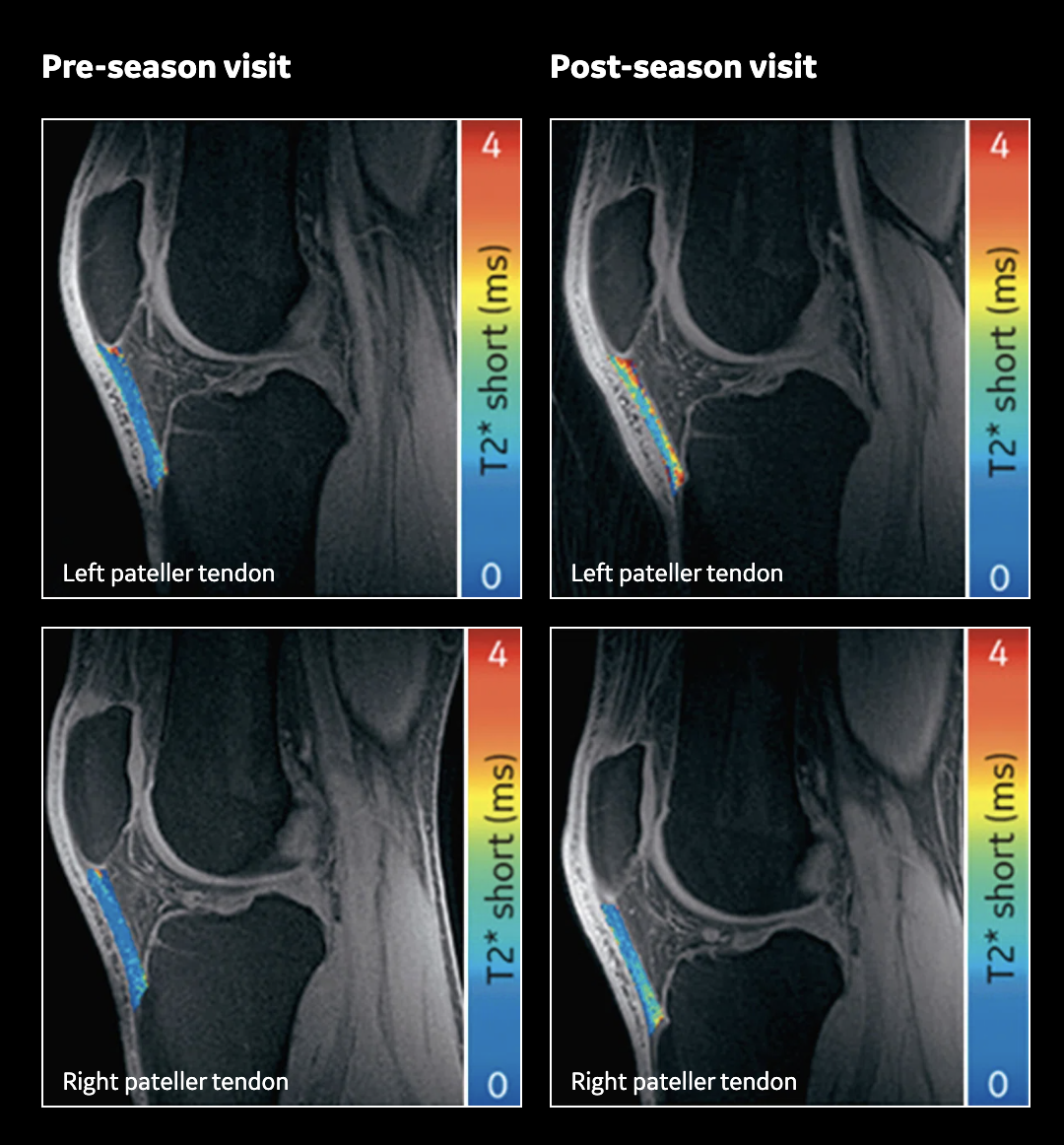 NBA, NBPA, and NGBPU Collaborate with GE HealthCare and MedStar Health on Musculoskeletal and Joint Health Study NBA, NBPA, and NGBPU Collaborate with GE HealthCare and MedStar Health on Musculoskeletal and Joint Health Study