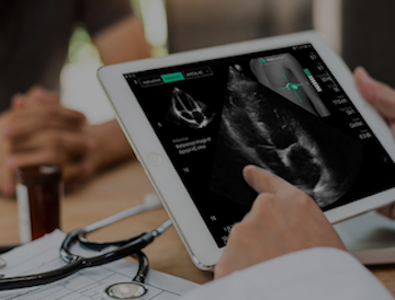 UltraSight, Jefferson Health Partner to Expand Access to Cardiac Imaging