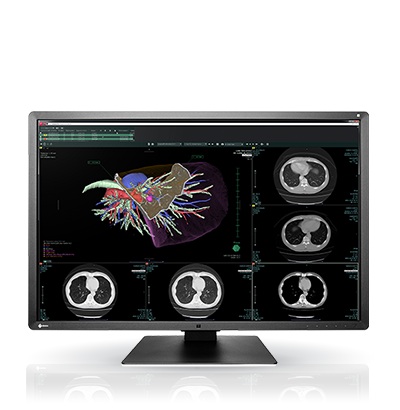X0000_Eizo_RadiForce_RX660_med