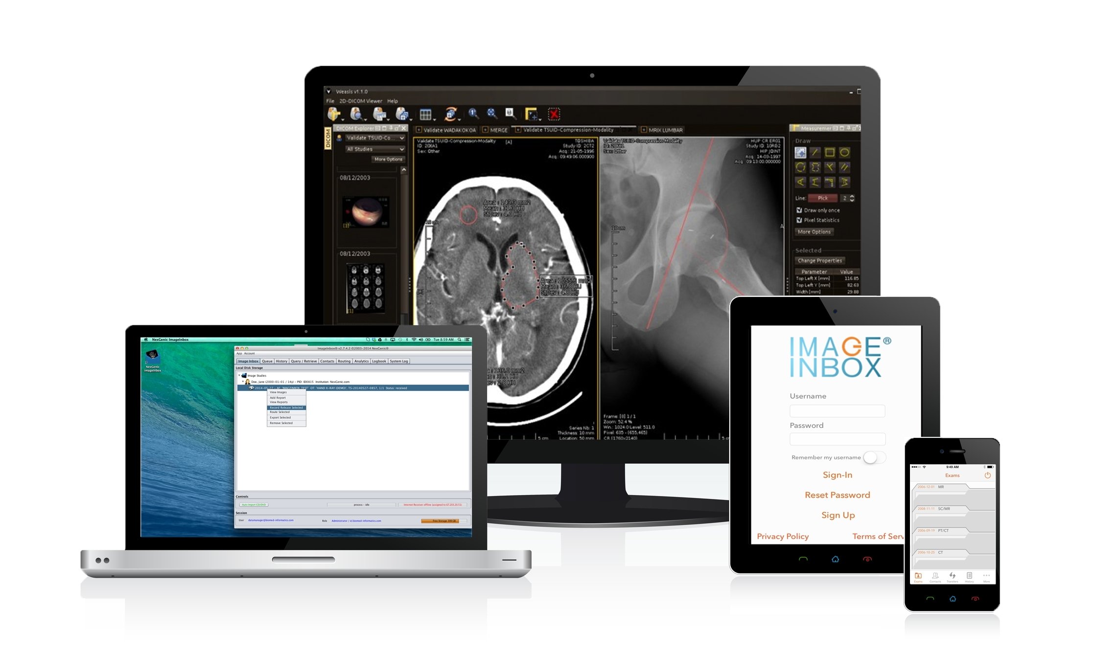 NexGenic Launches ImageInbox App for Seamless, HIPAA-compliant Delivery of Medical Imaging Between Patients, Healthcare Providers | Imaging Technology News