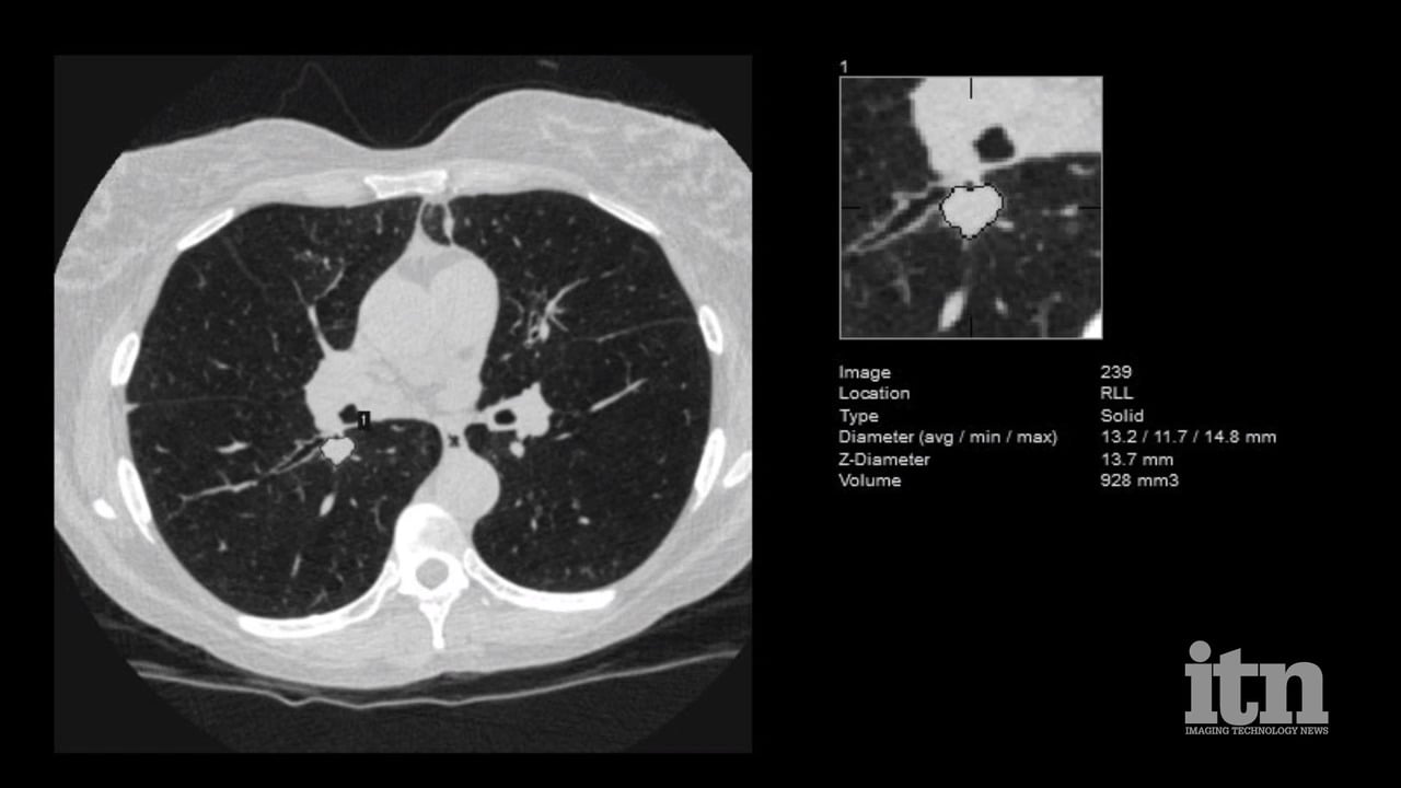 Technology Report: Artificial Intelligence in Radiology 2021 | Imaging  Technology News