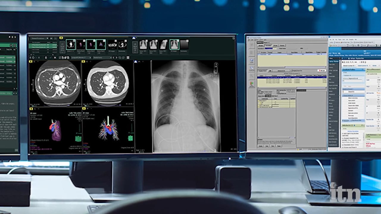 Radiology PACS System  Image Quality by Fujifilm Healthcare