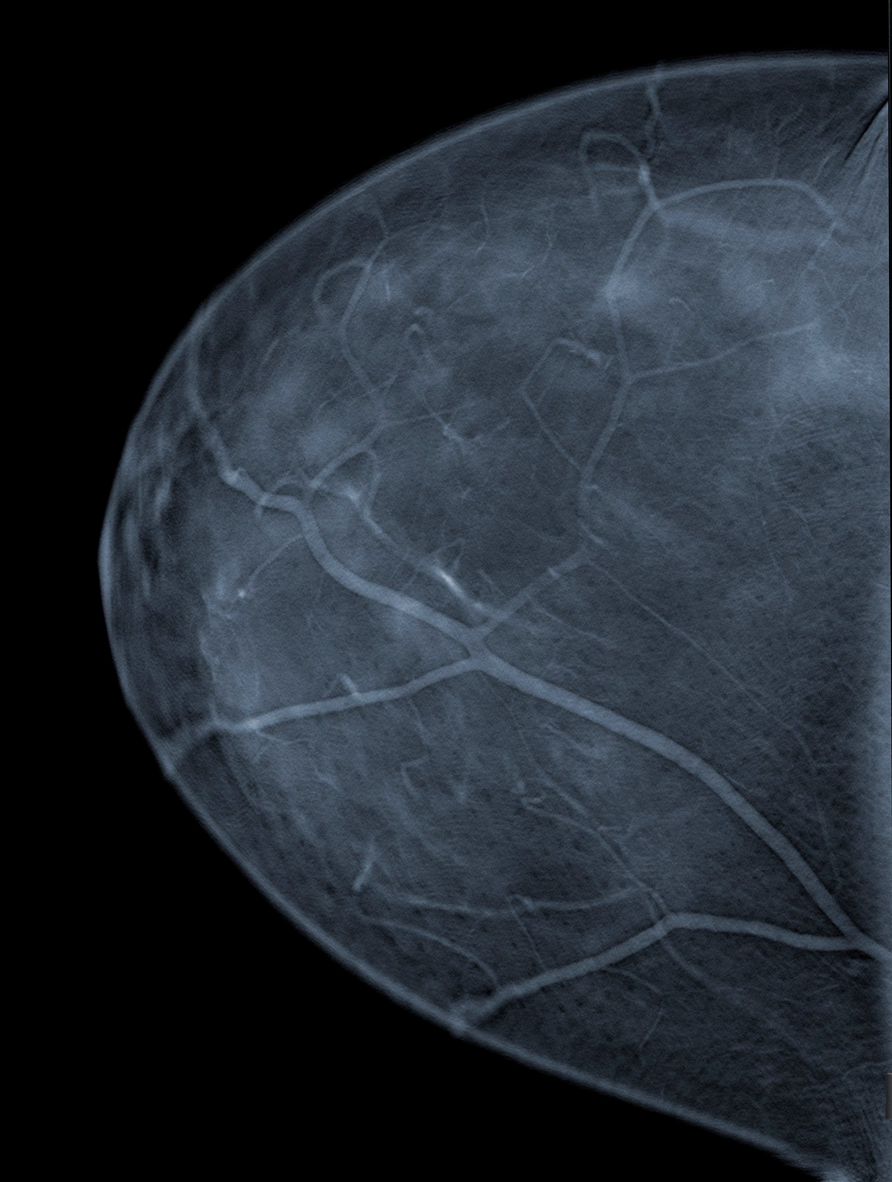 FDA MQSA Mammography Full-Field Digital FFDM Women's Health 