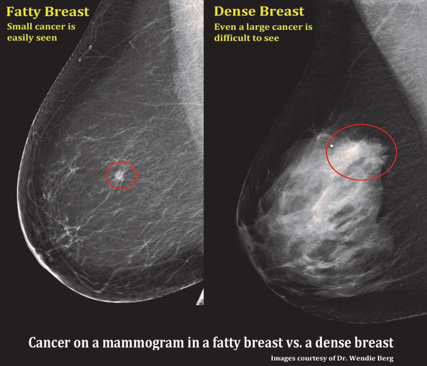 A photograph of the patient's left breast. Clinical appearance of