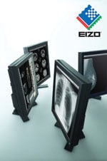 All Eizo medical-grade monitors are adjusted for uniform brightness and DICOM calibration