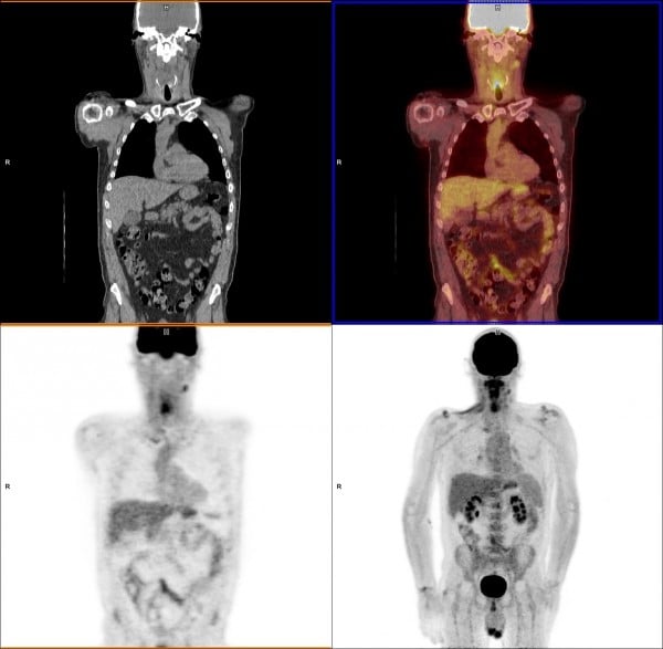 vejledning jubilæum ekstremt PET Scans & Imaging 101 | Imaging Technology News