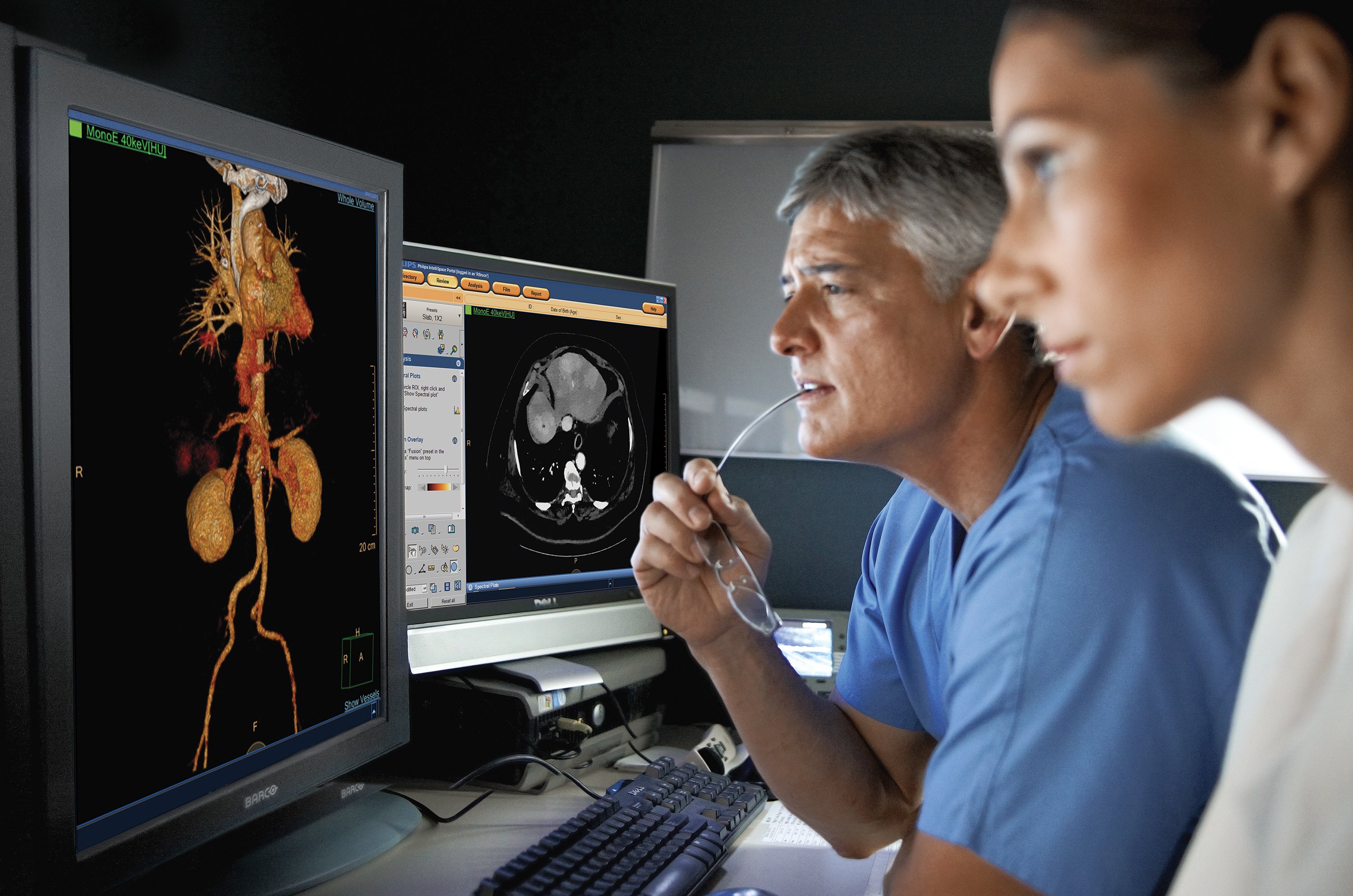Cardiologists using the Philips spectral CT software to view a spectral CT image reconstruction at various energy levels.