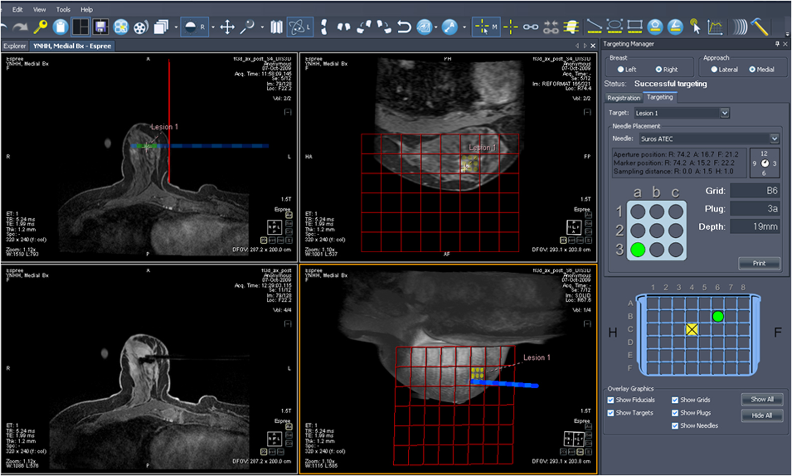 hologic_breast_mri.jpg hologic_breast_mri.jpg