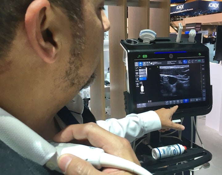 AI is integrated into GE Healthcare's new Venue Go point-of-care ultrasound system (POCUS) to automate image measurements and track them over time withe repeat imaging on the same patient. It is an example of the large imaging vendors integrating AI into their products.