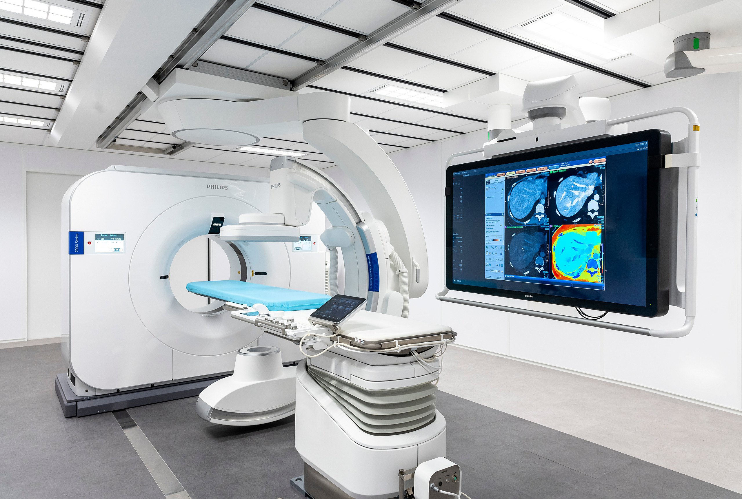 risiko rig hoste Making the Invisible Visible: Spectral CT 7500 Transforms Patient Care with  First-time-right Diagnosis | Imaging Technology News