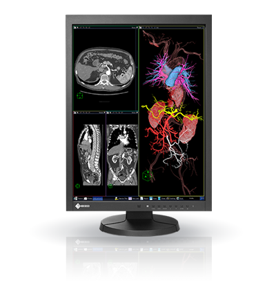 Eizo Releases 2 MP Monitor with 