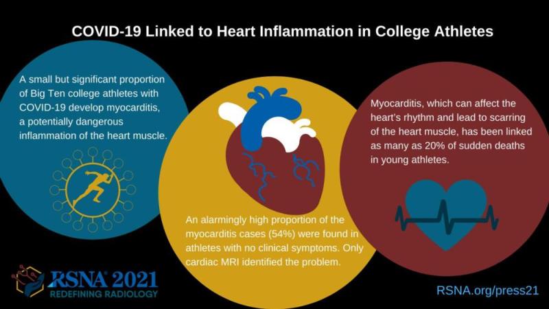 This infographic shows how COVID-19 is linked to heart inflammation in college athletes.