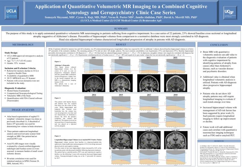  UCLA Brain MRI poster memory loss