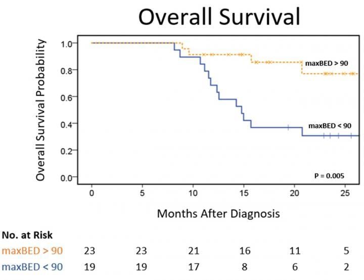 MRIdian MRI-guided radiotherapy overall survival for pancreatic cancer patients