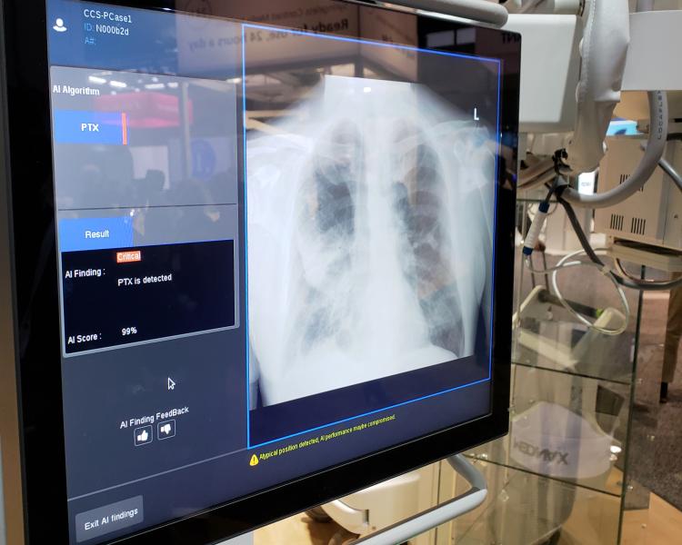 GE Healthcare demonstrated an experimental X-ray-based algorithm, designed to be embedded in its high-end portable X-ray machine, the Optima XR240amx