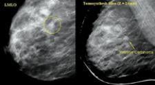 Aurora Imaging Technology Inc. developed MRI for the breast to assist in early detection of breast cancer.