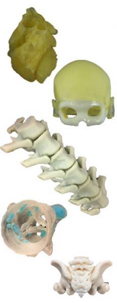A variety of 3-D printed models displayed by Stratasys at a recent RSNA conference.