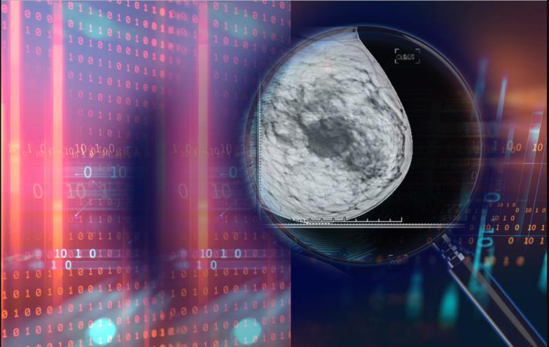 A recent study earlier this year in the journal Nature, which included researchers from Google Health London, demonstrated that artificial intelligence (AI) technology outperformed radiologists in diagnosing breast cancer on mammograms