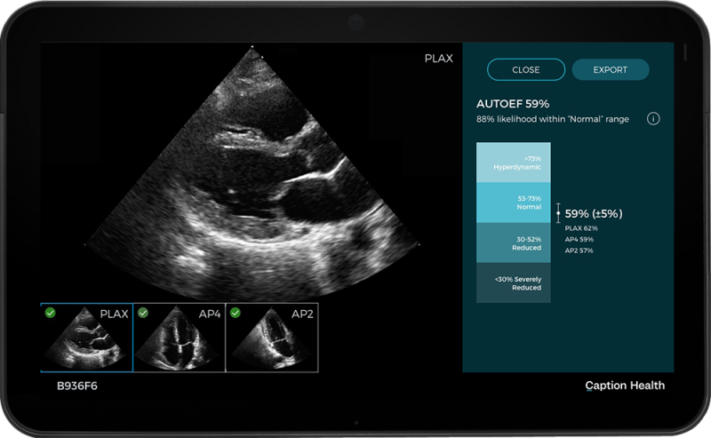 Acquisition supports GE HealthCare’s $3 billion Ultrasound business by adding AI-enabled image guidance to ultrasound device portfolios