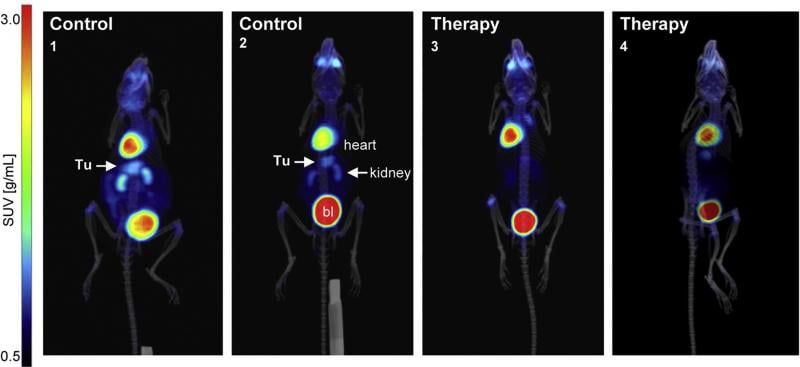 3-D PET/CT in situ detection of gastric tumors in mouse stomachs. Signals from 18F-FDG uptake in fasudil-treated (4 weeks) and control mice presented as graded color code with standard uptake value (SUVbw) range of 0.5-10. (Tu = tumor, bl =bladder). Arrows show the gastric tumor between the two kidneys and below the heart