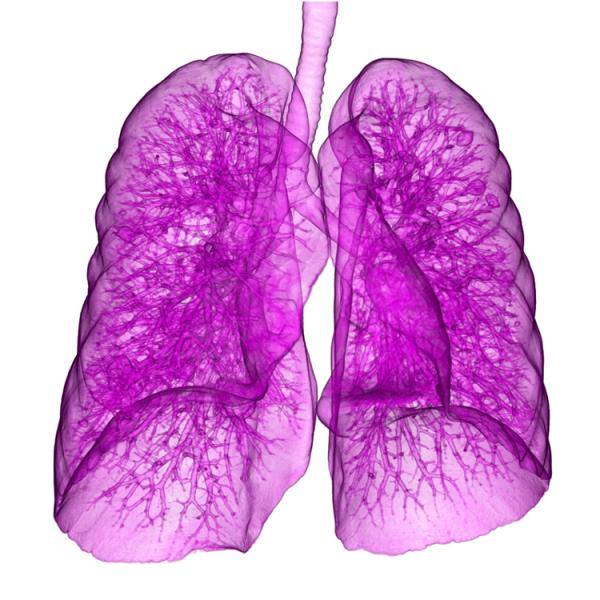 Terry Fox clinical trial/study CT systems computer-aided detection lung cancer