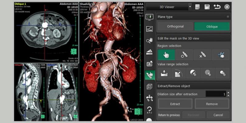 Fujifilm’s Synapse 3D delivers clinical value through consistently accurate and fast image processing for radiology, cardiology and surgical pre-operational simulation.