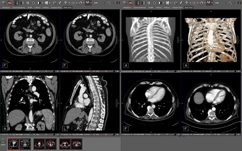 Visage 7 has advanced enterprise imaging based on the proven ability to replace legacy PACS for imaging organizations of all sizes and local, regional or national scale.