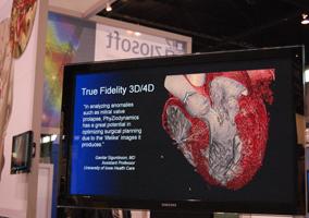 Ziosoft's Phyziodynamic software allows 3-D images data sets of the cardiac cycle to be put in motion.