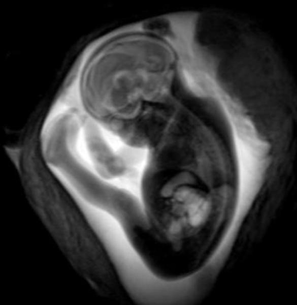 Figure 2. Image of fetus.