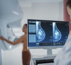 iCAD implements ProFound AI Detection to improve mammography reading and breast cancer detection in low-resource institutions and medically underserved communities