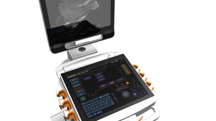 touch screen ultrasound, Carestream Touch
