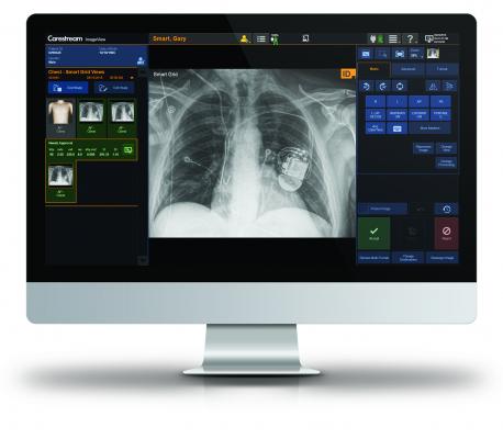 Carestream's Eclipse Image Processing engine, which powers Carestream software such as ImageView, aims to deliver quantifiable benefits to the radiologist and patient.