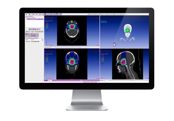DOSIsoft Releases ISOgray Proton Therapy Treatment Planning System