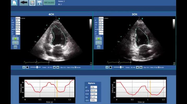 DiA Imaging Analysis Partners With GE Healthcare on Automatic Imaging Analysis Tools