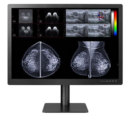 Double Black Imaging expands their line of displays for digital breast imaging with the Gemini 12MP, featuring a wizard designed specifically for MQSA testing, reporting and alerting