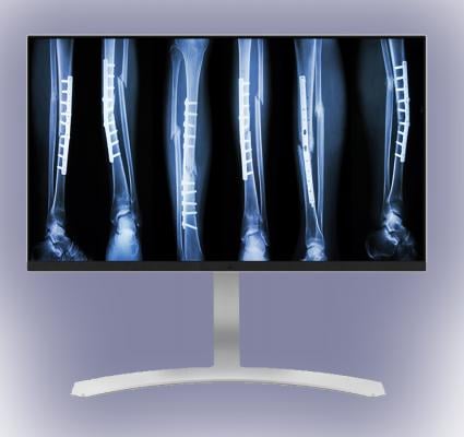 Double Black Imaging Announces Expanded Display Line and Ergonomic Workstation Solutions