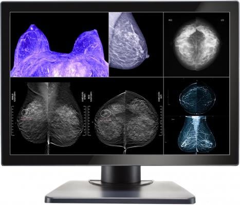 Double Black Announces Gemini Series Monitors for Multimodality and Digital Breast Imaging