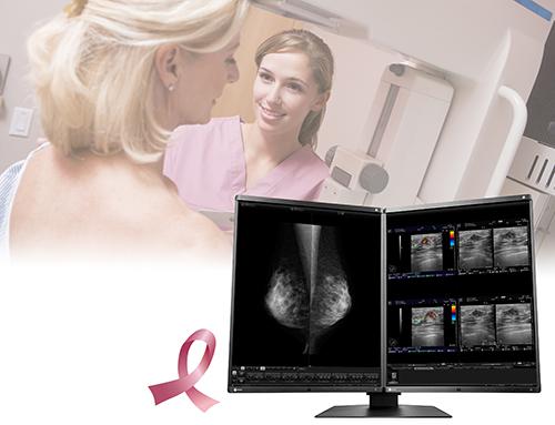 Eizo RadiForce RX560 Monitor Receives FDA 510(k) for Tomosynthesis and Digital Mammography
